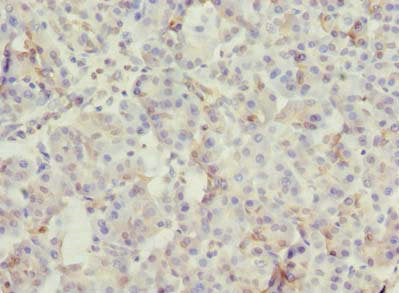 Immunohistochemistry of paraffin-embedded human pancreatic tissue using ROGDI Antibody at dilution of 1:100Rabbit anti-Human ROGDI Polyclonal Antibody