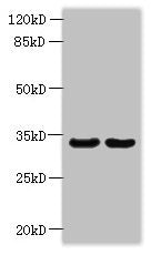 Western blot  | All lanes: ROGDI antibody at 1.2µg/ml  | Lane 1: Hela whole cell lysate  | Lane 2: K562 whole cell lysate  | Secondary  | Goat polyclonal to rabbit IgG at 1/10000 dilution  | Predicted band size: 33 kDa  | Observed band size: 33 kDaRabbit anti-Human ROGDI Polyclonal Antibody