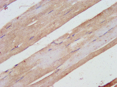 IHC image of SHARPIN Antibody diluted at 1:500 and staining in paraffin-embedded human skeletal muscle tissue performed on a Leica BondTM system. After dewaxing and hydration, antigen retrieval was mediated by high pressure in a citrate buffer (pH 6.0). Section was blocked with 10% normal goat serum 30min at RT. Then primary antibody (1% BSA) was incubated at 4°C overnight. The primary is detected by a biotinylated secondary antibody and visualized using an HRP conjugated SP system.Rabbit anti-Human SHARPIN Polyclonal Antibody