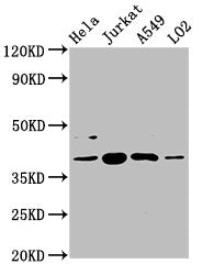 Western Blot  | Positive WB detected in: Hela whole cell lysate, Jurkat whole cell lysate, A549 whole cell lysate, LO2 whole cell lysate  | All lanes: SHARPIN antibody at 5.4µg/ml  | Secondary  | Goat polyclonal to rabbit IgG at 1/50000 dilution  | Predicted band size: 40, 34 kDa  | Observed band size: 40 kDaRabbit anti-Human SHARPIN Polyclonal Antibody
