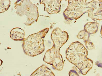 Immunohistochemistry of paraffin-embedded human placenta tissue using ENKD1 Antibody at dilution of 1:100Rabbit anti-Human ENKD1 Polyclonal Antibody