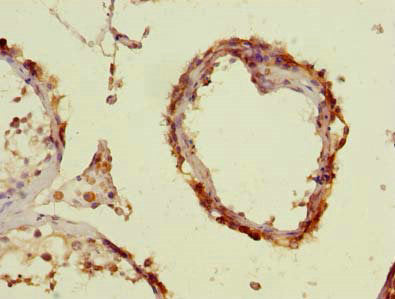 Immunohistochemistry of paraffin-embedded human testis tissue using ENKD1 Antibody at dilution of 1:100Rabbit anti-Human ENKD1 Polyclonal Antibody