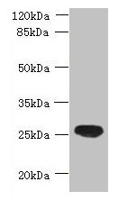 Western blot  | All lanes: ENKD1 antibody at 7µg/ml + Mouse brain tissue  | Secondary  | Goat polyclonal to rabbit IgG at 1/10000 dilution  | Predicted band size: 39, 26 kDa  | Observed band size: 26 kDaRabbit anti-Human ENKD1 Polyclonal Antibody