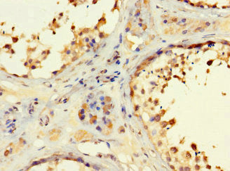 Immunohistochemistry of paraffin-embedded human testis tissue using RSPH9 Antibody at dilution of 1:100Rabbit anti-Human RSPH9 Polyclonal Antibody