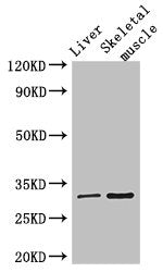 Western Blot | Positive WB detected in: Mouse liver tissue, Mouse skeletal muscle tissue | All lanes: RSPH9 antibody at 3μg/ml | Secondary | Goat polyclonal to rabbit IgG at 1/50000 dilution | Predicted band size: 32, 35 kDa | Observed band size: 32 kDaRabbit anti-Human RSPH9 Polyclonal Antibody