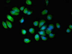 Immunofluorescent analysis of MCF-7 cells using EPN3 Antibody at dilution of 1:100 and Alexa Fluor 488-congugated AffiniPure Goat Anti-Rabbit IgG(H+L)Rabbit anti-Human EPN3 Polyclonal Antibody