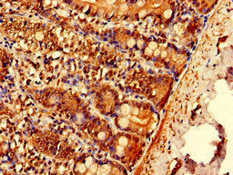 Immunohistochemistry of paraffin-embedded human small intestine tissue using the antibody at dilution of 1:100Rabbit anti-Human EPN3 Polyclonal Antibody