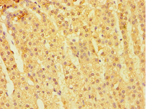 Immunohistochemistry of paraffin-embedded human adrenal gland tissue using CARD9 Antibody at dilution of 1:100