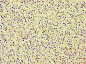 Immunohistochemistry of paraffin-embedded human spleen tissue using CARD9 Antibody at dilution of 1:100