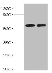 Western blot | All lanes: CARD9 antibody at 15μg/ml | Lane 1: THP-1 whole cell lysate | Lane 2: Jurkat whole cell lysate | Secondary | Goat polyclonal to rabbit IgG at 1/10000 dilution | Predicted band size: 63, 57, 43 kDa | Observed band size: 63 kDa