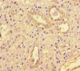 Immunohistochemistry of paraffin-embedded human kidney tissue using the antibody at dilution of 1:100Rabbit anti-Human TNKS2 Polyclonal Antibody