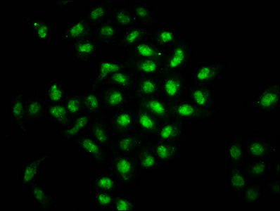 Immunofluorescence staining of Hela cells with BOLA2 Antibody at 1:66, counter-stained with DAPI. The cells were fixed in 4% formaldehyde, permeabilized using 0.2% Triton X-100 and blocked in 10% normal Goat Serum. The cells were then incubated with the antibody overnight at 4°C. The secondary antibody was Alexa Fluor 488-congugated AffiniPure Goat Anti-Rabbit IgG(H+L).