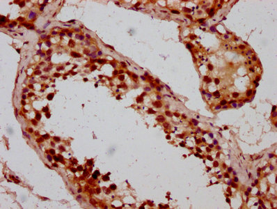 IHC image of BOLA2 Antibody diluted at 1:200 and staining in paraffin-embedded human testis tissue performed on a Leica BondTM system. After dewaxing and hydration, antigen retrieval was mediated by high pressure in a citrate buffer (pH 6.0). Section was blocked with 10% normal goat serum 30min at RT. Then primary antibody (1% BSA) was incubated at 4°C overnight. The primary is detected by a biotinylated secondary antibody and visualized using an HRP conjugated SP system.