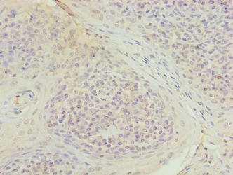 Immunohistochemistry of paraffin-embedded human tonsil tissue using the antibody at dilution of 1:100Rabbit anti-Human TUBB1 Polyclonal Antibody