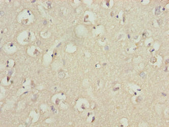 Immunohistochemistry of paraffin-embedded human brain tissue using TUBB1 Antibody at dilution of 1:100Rabbit anti-Human TUBB1 Polyclonal Antibody