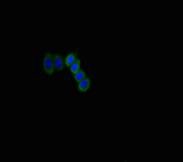 Immunofluorescent analysis of HepG2 cells using SLITRK6 Antibody at dilution of 1:100 and Alexa Fluor 488-congugated AffiniPure Goat Anti-Rabbit IgG(H+L)Rabbit anti-Human SLITRK6 Polyclonal Antibody
