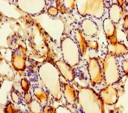 Immunohistochemistry of paraffin-embedded human thyroid tissue using the antibody at dilution of 1:100Rabbit anti-Human SLITRK6 Polyclonal Antibody