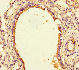 Immunohistochemistry of paraffin-embedded human lung tissue using SLITRK6 Antibody at dilution of 1:100Rabbit anti-Human SLITRK6 Polyclonal Antibody