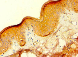 Immunohistochemistry of paraffin-embedded human skin tissue using HAUS4 Antibody at dilution of 1:100Rabbit anti-Human HAUS4 Polyclonal Antibody