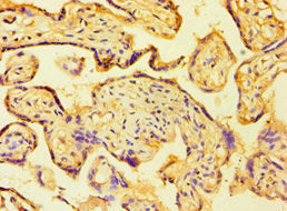 Immunohistochemistry of paraffin-embedded human placenta tissue using HAUS4 Antibody at dilution of 1:100Rabbit anti-Human HAUS4 Polyclonal Antibody