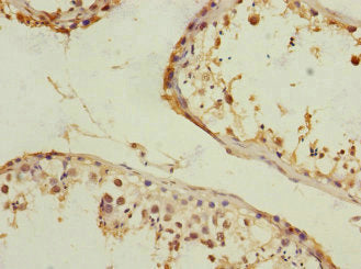 Immunohistochemistry of paraffin-embedded human testis tissue using RANBP3 Antibody at dilution of 1:100Rabbit anti-Human RANBP3 Polyclonal Antibody