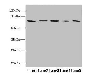 Western blot | All lanes: RANBP3 antibody at 6.4μg/ml | Lane 1: Mouse brain tissue | Lane 2: Hela whole cell lysate | Lane 3: HepG2 whole cell lysate | Lane 4: Jurkat whole cell lysate | Lane 5: MCF-7 whole cell lysate | Secondary | Goat polyclonal to rabbit IgG at 1/10000 dilution | Predicted band size: 61, 60, 54 kDa | Observed band size: 61 kDaRabbit anti-Human RANBP3 Polyclonal Antibody