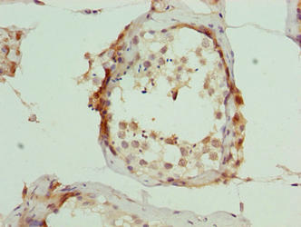 Immunohistochemistry of paraffin-embedded human testis tissue using ARMT1 Antibody at dilution of 1:100Rabbit anti-Human ARMT1 Polyclonal Antibody