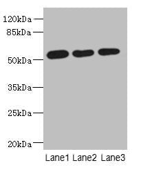 Western blot  | All lanes: ARMT1 antibody at 0.6µg/ml  | Lane 1: MCF-7 whole cell lysate  | Lane 2: A431 whole cell lysate  | Lane 3: 293T whole cell lysate  | Secondary  | Goat polyclonal to rabbit IgG at 1/10000 dilution  | Predicted band size: 52 kDa  | Observed band size: 52 kDaRabbit anti-Human ARMT1 Polyclonal Antibody