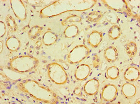Immunohistochemistry of paraffin-embedded human kidney tissue using SUGCT Antibody at dilution of 1:100Rabbit anti-Human SUGCT Polyclonal Antibody