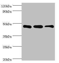 Western blot | All lanes: SUGCT antibody at 16μg/ml | Lane 1: Mouse skeletal muscle tissue | Lane 2: Mouse liver tissue | Lane 3: Mouse kidney tissue | Secondary | Goat polyclonal to rabbit IgG at 1/10000 dilution | Predicted band size: 49, 48, 52, 44 kDa | Observed band size: 42 kDaRabbit anti-Human SUGCT Polyclonal Antibody
