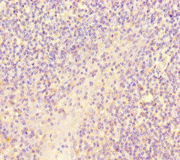 Immunohistochemistry of paraffin-embedded human tonsil tissue using SCPEP1 Antibody at dilution of 1:100Rabbit anti-Human SCPEP1 Polyclonal Antibody