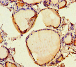 Immunohistochemistry of paraffin-embedded human thyroid tissue using SCPEP1 Antibody at dilution of 1:100Rabbit anti-Human SCPEP1 Polyclonal Antibody