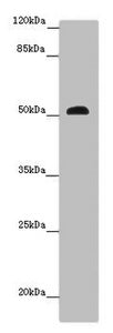 Western blot | All lanes: SCPEP1 antibody at 9 μg/ml + Mouse stomach tissue | Secondary | Goat polyclonal to rabbit IgG at 1/10000 dilution | Predicted band size: 51, 33 kDa | Observed band size: 51 kDaRabbit anti-Human SCPEP1 Polyclonal Antibody