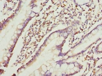 Immunohistochemistry of paraffin-embedded human small intestine tissue using RRAGC Antibody at dilution of 1:100Rabbit anti-Human RRAGC Polyclonal Antibody