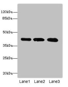 Western blot  | All lanes: RRAGC antibody at 1.14µg/ml  | Lane 1: Hela whole cell lysate  | Lane 2: MCF-7 whole cell lysate  | Lane 3: A549 whole cell lysate  | Secondary  | Goat polyclonal to rabbit IgG at 1/10000 dilution  | Predicted band size: 44 kDa  | Observed band size: 44 kDaRabbit anti-Human RRAGC Polyclonal Antibody