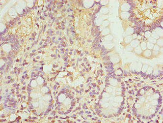 Immunohistochemistry of paraffin-embedded human small intestine tissue using RHOF Antibody at dilution of 1:100Rabbit anti-Human RHOF Polyclonal Antibody