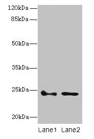 Western blot  | All lanes: RHOF antibody at 3µg/ml  | Lane 1: Colo320 whole cell lysate  | Lane 2: RAW264.7 whole cell lysate  | Secondary  | Goat polyclonal to rabbit IgG at 1/10000 dilution  | Predicted band size: 24, 19 kDa  | Observed band size: 24 kDaRabbit anti-Human RHOF Polyclonal Antibody