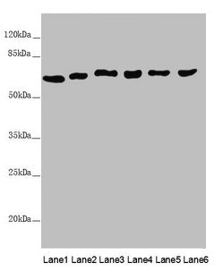 Western blot  | All lanes: MCCC2 antibody at 6.85µg/ml  | Lane 1: Mouse brain tissue  | Lane 2: Hela whole cell lysate  | Lane 3: MCF-7 whole cell lysate  | Lane 4: K562 whole cell lysate  | Lane 5: HepG2 whole cell lysate  | Lane 6: A549 whole cell lysate  | Secondary  | Goat polyclonal to rabbit IgG at 1/10000 dilution  | Predicted band size: 62, 58 kDa  | Observed band size: 62 kDa