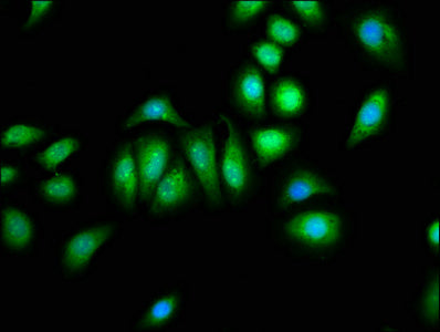 Immunofluorescence staining of A549 cells with PNPLA8 Antibody at 1:133, counter-stained with DAPI. The cells were fixed in 4% formaldehyde, permeabilized using 0.2% Triton X-100 and blocked in 10% normal Goat Serum. The cells were then incubated with the antibody overnight at 4°C. The secondary antibody was Alexa Fluor 488-congugated AffiniPure Goat Anti-Rabbit IgG(H+L).Rabbit anti-Human PNPLA8 Polyclonal Antibody