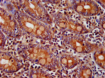 IHC image of PNPLA8 Antibody diluted at 1:400 and staining in paraffin-embedded human small intestine tissue performed on a Leica BondTM system. After dewaxing and hydration, antigen retrieval was mediated by high pressure in a citrate buffer (pH 6.0). Section was blocked with 10% normal goat serum 30min at RT. Then primary antibody (1% BSA) was incubated at 4°C overnight. The primary is detected by a biotinylated secondary antibody and visualized using an HRP conjugated SP system.Rabbit anti-Human PNPLA8 Polyclonal Antibody