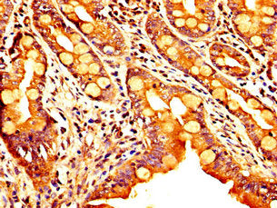 IHC image of SEMA4B Antibody diluted at 1:300 and staining in paraffin-embedded human small intestine tissue performed on a Leica BondTM system. After dewaxing and hydration, antigen retrieval was mediated by high pressure in a citrate buffer (pH 6.0). Section was blocked with 10% normal goat serum 30min at RT. Then primary antibody (1% BSA) was incubated at 4°C overnight. The primary is detected by a biotinylated secondary antibody and visualized using an HRP conjugated SP system.Rabbit anti-Human SEMA4B Polyclonal Antibody