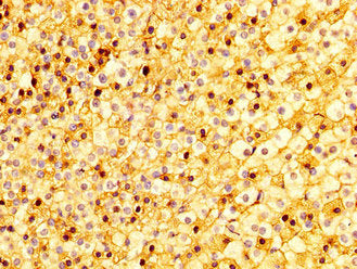 IHC image of SEMA4B Antibody diluted at 1:300 and staining in paraffin-embedded human adrenal gland tissue performed on a Leica BondTM system. After dewaxing and hydration, antigen retrieval was mediated by high pressure in a citrate buffer (pH 6.0). Section was blocked with 10% normal goat serum 30min at RT. Then primary antibody (1% BSA) was incubated at 4°C overnight. The primary is detected by a biotinylated secondary antibody and visualized using an HRP conjugated SP system.Rabbit anti-Human SEMA4B Polyclonal Antibody