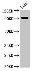 Western Blot | Positive WB detected in: Rat luing tissue | All lanes: SEMA4B antibody at 6.3μg/ml | Secondary | Goat polyclonal to rabbit IgG at 1/50000 dilution | Predicted band size: 93, 82 kDa | Observed band size: 93 kDaRabbit anti-Human SEMA4B Polyclonal Antibody