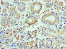 Immunohistochemistry of paraffin-embedded human salivary gland tissue using CCL28 Antibody at dilution of 1:100Rabbit anti-Human CCL28 Polyclonal Antibody