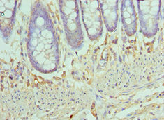 Immunohistochemistry of paraffin-embedded human colon tissue using CCL28 Antibody at dilution of 1:100Rabbit anti-Human CCL28 Polyclonal Antibody
