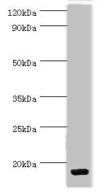 Western blot | All lanes: C-C motif chemokine 28 antibody at 5μg/ml + Mouse spleen tissue | Secondary | Goat polyclonal to rabbit IgG at 1/10000 dilution | Predicted band size: 15, 13 kDa | Observed band size: 15 kDa