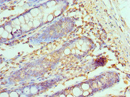 Immunohistochemistry of paraffin-embedded human colon tissue using CCL28 Antibody at dilution of 1:100Rabbit anti-Human CCL28 Polyclonal Antibody