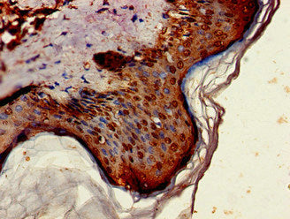 Immunohistochemistry of paraffin-embedded human skin tissue using ST6GALNAC1 Antibody at dilution of 1:100Rabbit anti-Human ST6GALNAC1 Polyclonal Antibody