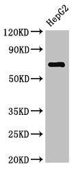 Western Blot | Positive WB detected in: HepG2 whole cell lysate | All lanes: ST6GALNAC1 antibody at 2.7μg/ml | Secondary | Goat polyclonal to rabbit IgG at 1/50000 dilution | Predicted band size: 69 kDa | Observed band size: 69 kDaRabbit anti-Human ST6GALNAC1 Polyclonal Antibody