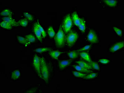 Immunofluorescence staining of Hela cells with PIGV Antibody at 1:66, counter-stained with DAPI. The cells were fixed in 4% formaldehyde, permeabilized using 0.2% Triton X-100 and blocked in 10% normal Goat Serum. The cells were then incubated with the antibody overnight at 4°C. The secondary antibody was Alexa Fluor 488-congugated AffiniPure Goat Anti-Rabbit IgG(H+L).Rabbit anti-Human PIGV Polyclonal Antibody